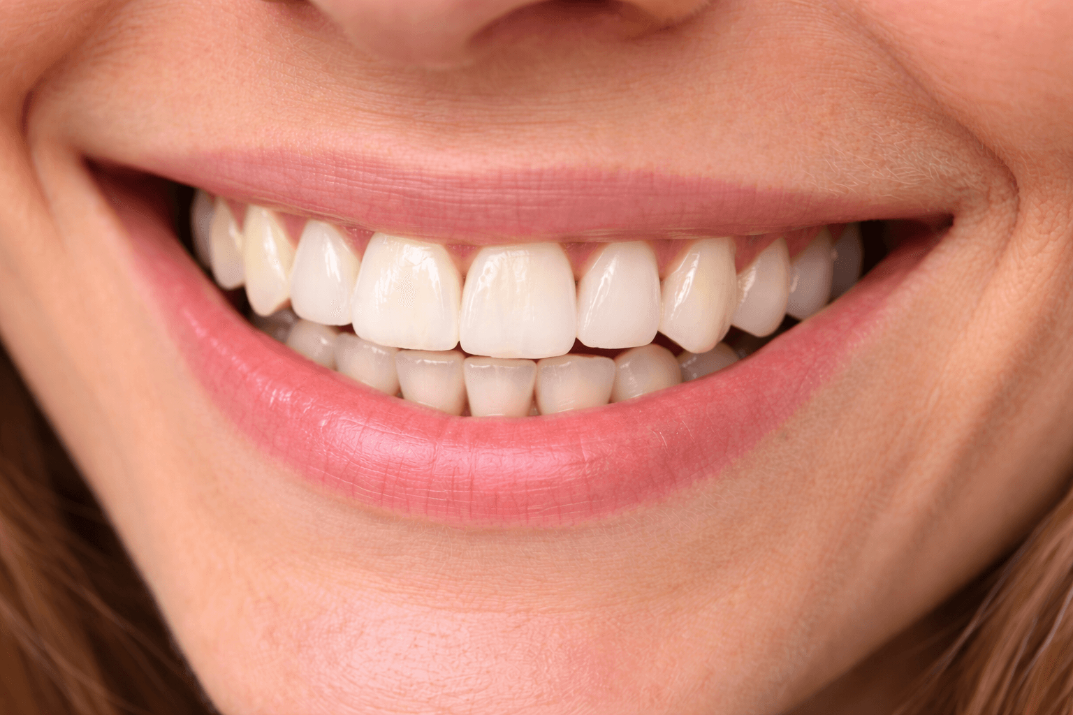 Dental Implants after